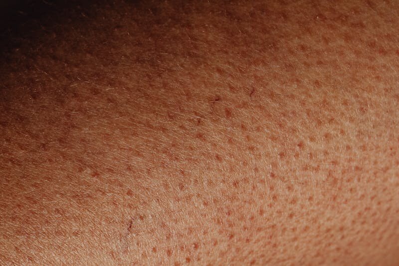 Details Zu 500 Ml Brustimplantat Bilder: Größen, Formen Und Sichtweisen